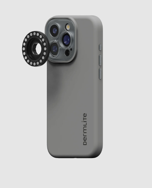 dermlite kit for iphone 16_1
