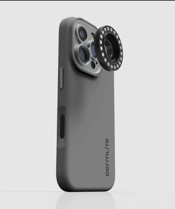 dermlite kit for iphone 16_2
